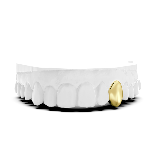 Single Tooth Cap