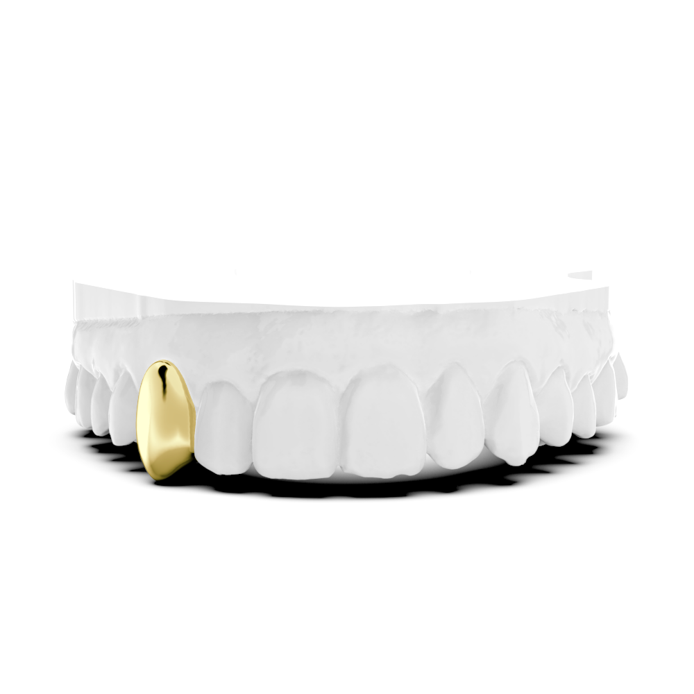 Single Tooth Cap