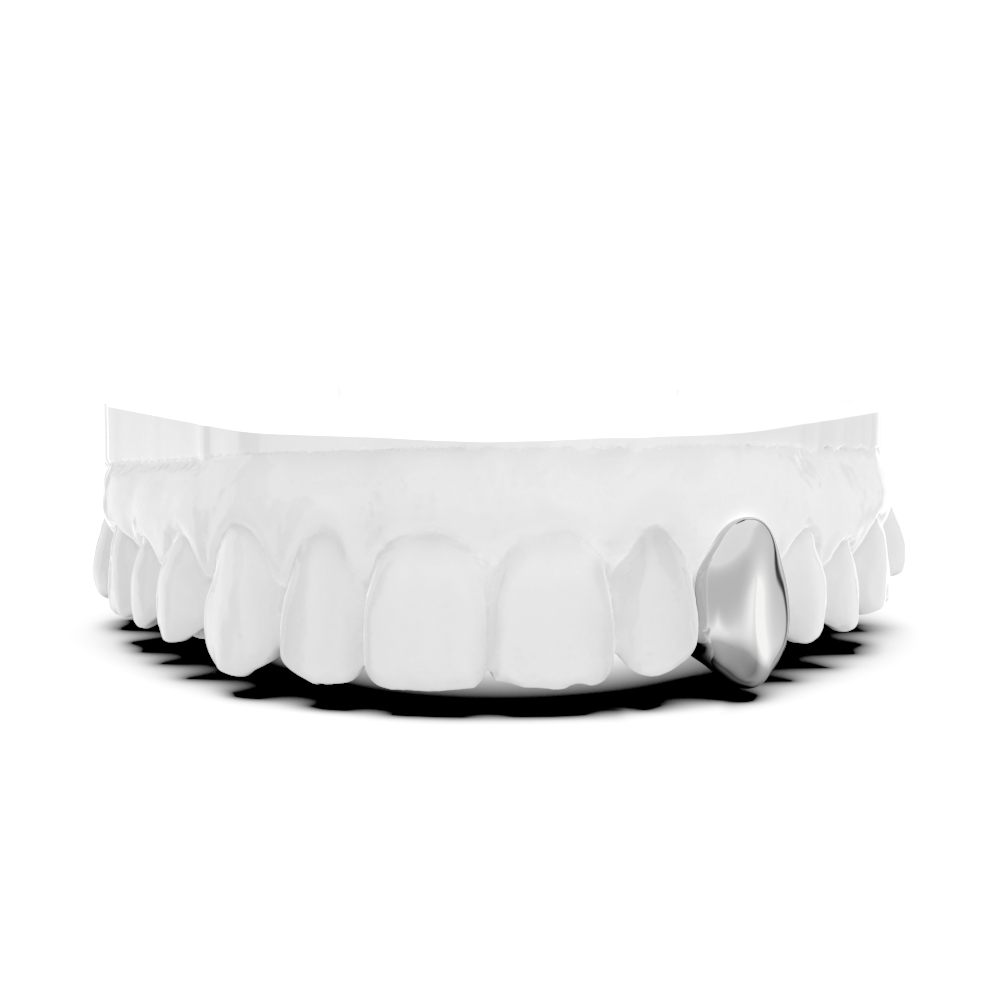 Single Tooth Cap